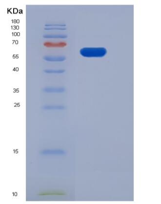 Recombinant Human EphB1 / EPHT2 Protein (His tag),Recombinant Human EphB1 / EPHT2 Protein (His tag)