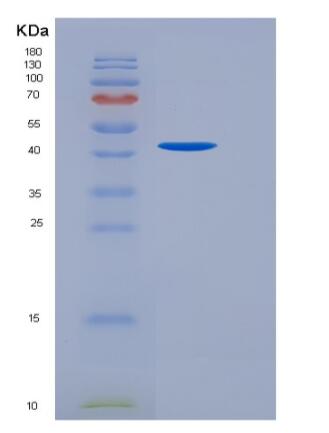 Recombinant Human TGFBR2 Protein (His &Fc Tag),Recombinant Human TGFBR2 Protein (His &Fc Tag)