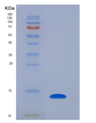 Recombinant Human KIAA0101 / p15 / PAF Protein (His tag),Recombinant Human KIAA0101 / p15 / PAF Protein (His tag)