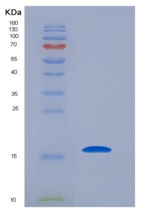 Recombinant Human Survivin / BIRC5 / API4 Protein,Recombinant Human Survivin / BIRC5 / API4 Protein