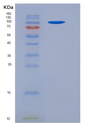 Recombinant Mouse VCL / Vinculin Protein (His tag),Recombinant Mouse VCL / Vinculin Protein (His tag)