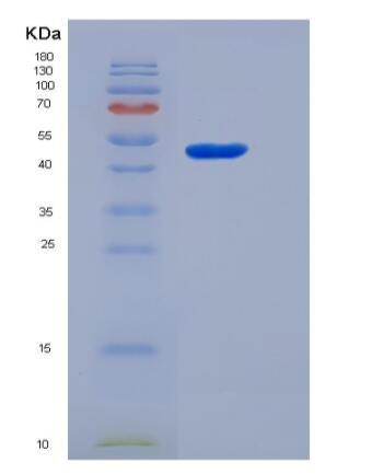 Recombinant Human Tryptophan Hydroxylase 1 / TPH1 Protein (His tag),Recombinant Human Tryptophan Hydroxylase 1 / TPH1 Protein (His tag)