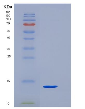 Recombinant Human CD3 epsilon / CD3e Protein (His Tag),Recombinant Human CD3 epsilon / CD3e Protein (His Tag)