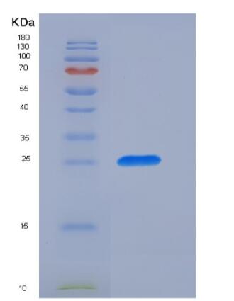 Recombinant Human CD89 / FCAR Protein (His tag),Recombinant Human CD89 / FCAR Protein (His tag)