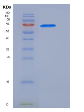 Recombinant Human GAD67 / GAD1 Protein (His tag),Recombinant Human GAD67 / GAD1 Protein (His tag)