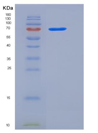 Recombinant Rat TrkB / NTRK2 Protein (Fc tag),Recombinant Rat TrkB / NTRK2 Protein (Fc tag)