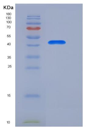 Recombinant Human Renin Protein (His tag),Recombinant Human Renin Protein (His tag)