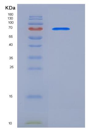 Recombinant Human CALR / Calreticulin Protein (Fc tag),Recombinant Human CALR / Calreticulin Protein (Fc tag)