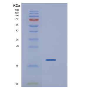 Recombinant Mouse REG3D Protein (His tag)