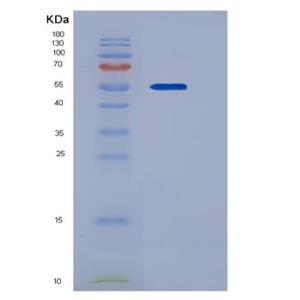 Recombinant Human ADAM15 / MDC15 Protein (His tag)