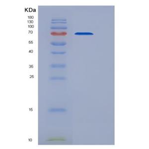 Recombinant Mouse CDCP1 Protein (His tag)