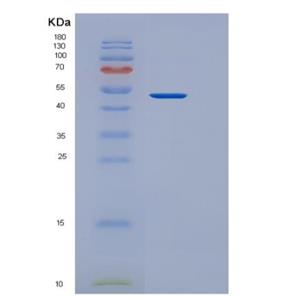 Recombinant Human METTL11A Protein (GST tag)