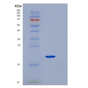 Recombinant Human CD4 / LEU3 Protein (aa 1-208, His tag),Recombinant Human CD4 / LEU3 Protein (aa 1-208, His tag)