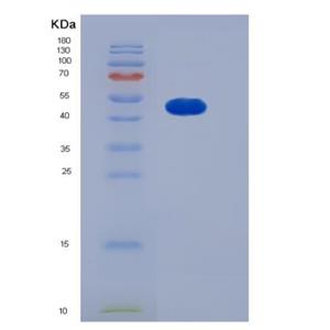 Recombinant Human SMYD2 / KMT3C Protein (His tag)