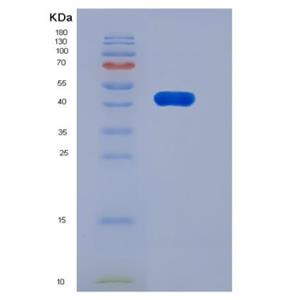 Recombinant Rat Carboxypeptidase B2 / CPB2 Protein (His Tag)