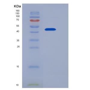 Recombinant Mouse Epcr / PROCR Protein (Fc tag)