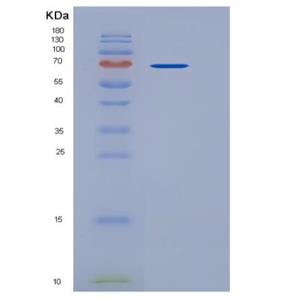Recombinant Human CD4 / LEU3 Protein (His & Fc tag),Recombinant Human CD4 / LEU3 Protein (His & Fc tag)