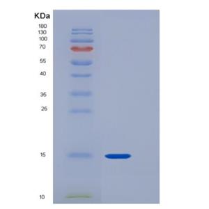Recombinant Rat CD90 / THY-1 Protein (His tag)