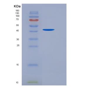 Recombinant Human TGFBR2 Protein (His &Fc Tag)