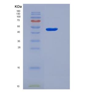 Recombinant Human Tryptophan Hydroxylase 1 / TPH1 Protein (His tag)