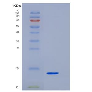 Recombinant Human CD3 epsilon / CD3e Protein (His Tag),Recombinant Human CD3 epsilon / CD3e Protein (His Tag)