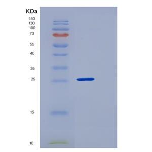 Recombinant Human CLEC12A / CLL-1 / DCAL2 Protein (His tag)