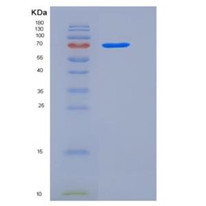 Recombinant Rat TrkB / NTRK2 Protein (Fc tag),Recombinant Rat TrkB / NTRK2 Protein (Fc tag)