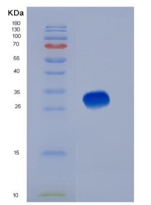 Eukaryotic Cluster Of Differentiation 147 (CD147),Eukaryotic Cluster Of Differentiation 147 (CD147)