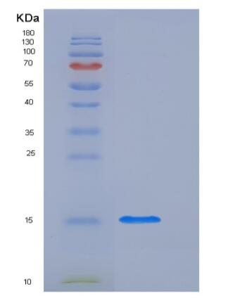 Recombinant Human L-FABP / FABP1 Protein (His tag),Recombinant Human L-FABP / FABP1 Protein (His tag)