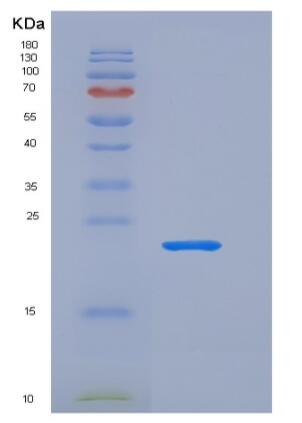 Recombinant Human LCN2 / NGAL Protein (His tag),Recombinant Human LCN2 / NGAL Protein (His tag)
