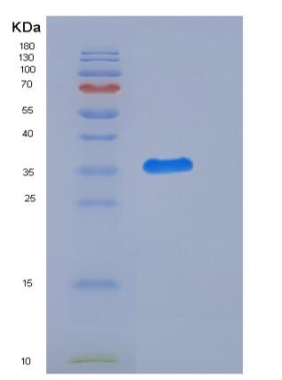 Recombinant Rat CD111 / Nectin-1 / PVRL1 Protein (His tag),Recombinant Rat CD111 / Nectin-1 / PVRL1 Protein (His tag)