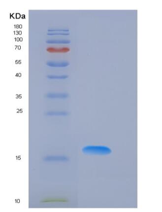 Recombinant Mouse Fas Protein (His Tag),Recombinant Mouse Fas Protein (His Tag)