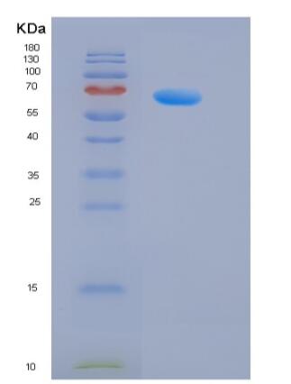 Recombinant Rat HER2 / ErbB2 Protein,Recombinant Rat HER2 / ErbB2 Protein