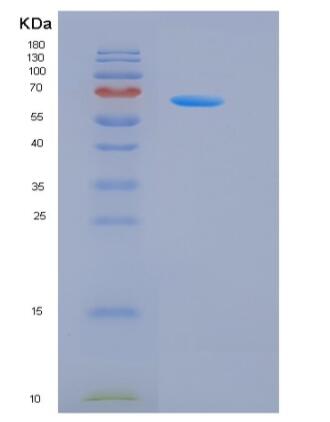 Recombinant Human G-CSFR / CD114 / CSF3R Protein,Recombinant Human G-CSFR / CD114 / CSF3R Protein