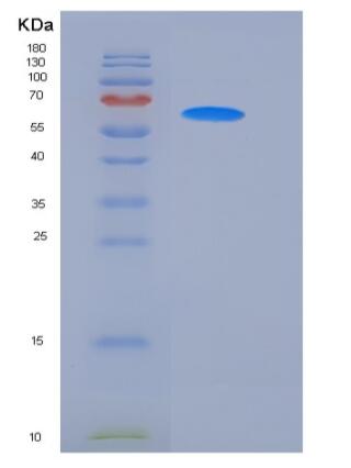 Recombinant Mouse CD14 Protein (His & Fc tag),Recombinant Mouse CD14 Protein (His & Fc tag)