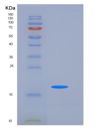 Recombinant Human NBL1 / DAND1 / DAN Protein (His tag),Recombinant Human NBL1 / DAND1 / DAN Protein (His tag)