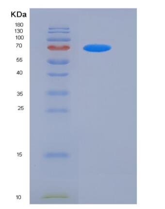 Recombinant Rat Her2 / ERBB2 Protein (His Tag),Recombinant Rat Her2 / ERBB2 Protein (His Tag)