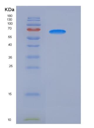 Recombinant Human G-CSFR / CD114 Protein (His tag),Recombinant Human G-CSFR / CD114 Protein (His tag)