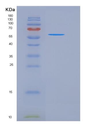 Recombinant Human SIGLEC6 / CD327 Protein (Fc tag),Recombinant Human SIGLEC6 / CD327 Protein (Fc tag)