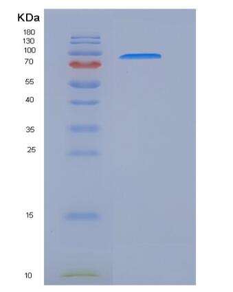 Recombinant Rat HER2 / ErbB2 Protein (Fc tag),Recombinant Rat HER2 / ErbB2 Protein (Fc tag)