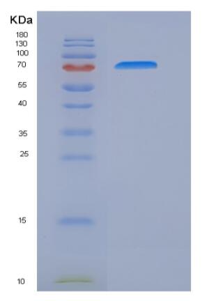 Recombinant Human IL17RC Protein (Fc tag),Recombinant Human IL17RC Protein (Fc tag)