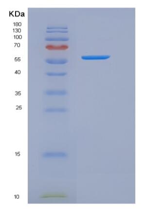 Recombinant Human IL17RA / CD217 Protein (His & Fc tag),Recombinant Human IL17RA / CD217 Protein (His & Fc tag)