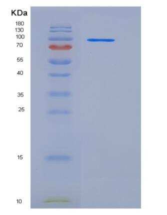 Recombinant Human G-CSFR / CD114 / CSF3R Protein (Fc tag),Recombinant Human G-CSFR / CD114 / CSF3R Protein (Fc tag)