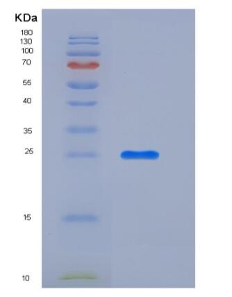 Recombinant Mouse CXADR Protein (His tag),Recombinant Mouse CXADR Protein (His tag)