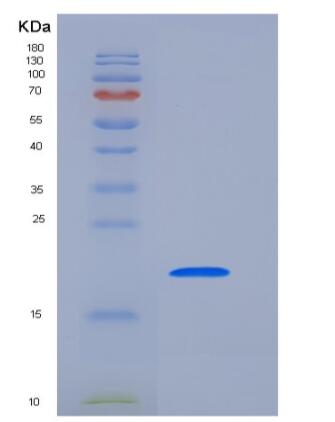 Recombinant Human PTH1R Protein (His Tag),Recombinant Human PTH1R Protein (His Tag)