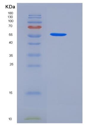 Recombinant Human tPA / PLAT Protein (Fc tag),Recombinant Human tPA / PLAT Protein (Fc tag)