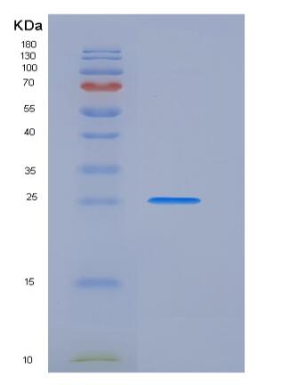 Recombinant Rat PRLR / Prolactin receptor Protein (His tag),Recombinant Rat PRLR / Prolactin receptor Protein (His tag)
