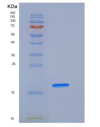Recombinant Human Fas Protein (His Tag),Recombinant Human Fas Protein (His Tag)