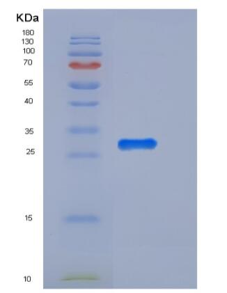Recombinant Mouse UCHL3 / UCH-L3 Protein (His tag),Recombinant Mouse UCHL3 / UCH-L3 Protein (His tag)