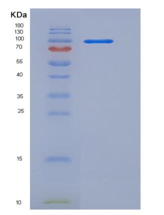 Recombinant Human C2 / Complement Component 2 Protein (Fc tag),Recombinant Human C2 / Complement Component 2 Protein (Fc tag)